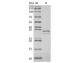 脱氧核糖核酸酶I DNase I上海惠诚生物.jpg