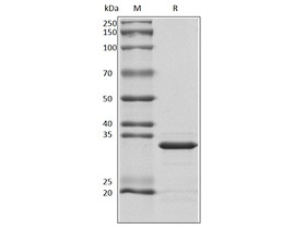 Human FN protein，His Tag上海惠诚生物.jpg